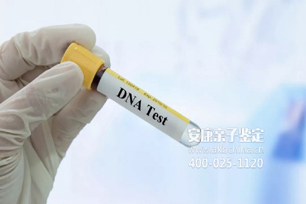 潍坊济南亲子鉴定可以选择做DNA或个人吗 
